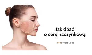 Jak dbać o cerę naczynkową? Skuteczne metody i porady eksperta