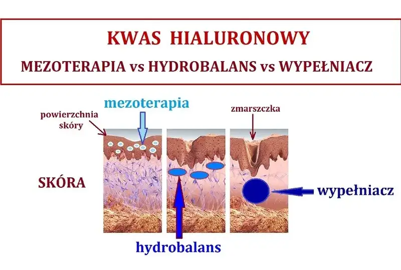 kwas hialuronowy w skórze schemat